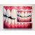 1 x Syringe Dentes Vitae In Ore Veritas
