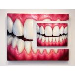 1 x Syringe Dentes Vitae In Ore Veritas